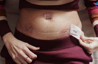 UK_BODYFORM_INNERTRUTHS_WOMBSTORIES_AWARENESS_BRAND_PR STILL_ENDOSTOMACH.jpg