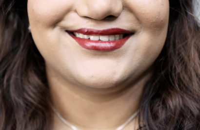 Nishchala Chitradurga. Visit Smile Train UK to help champion smile inclusivity (www.smiletrain.org.uk).jpg