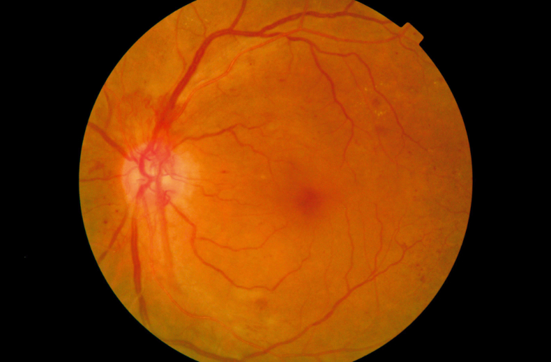 Eyeagnosis